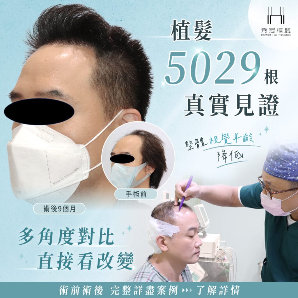 showhair-9