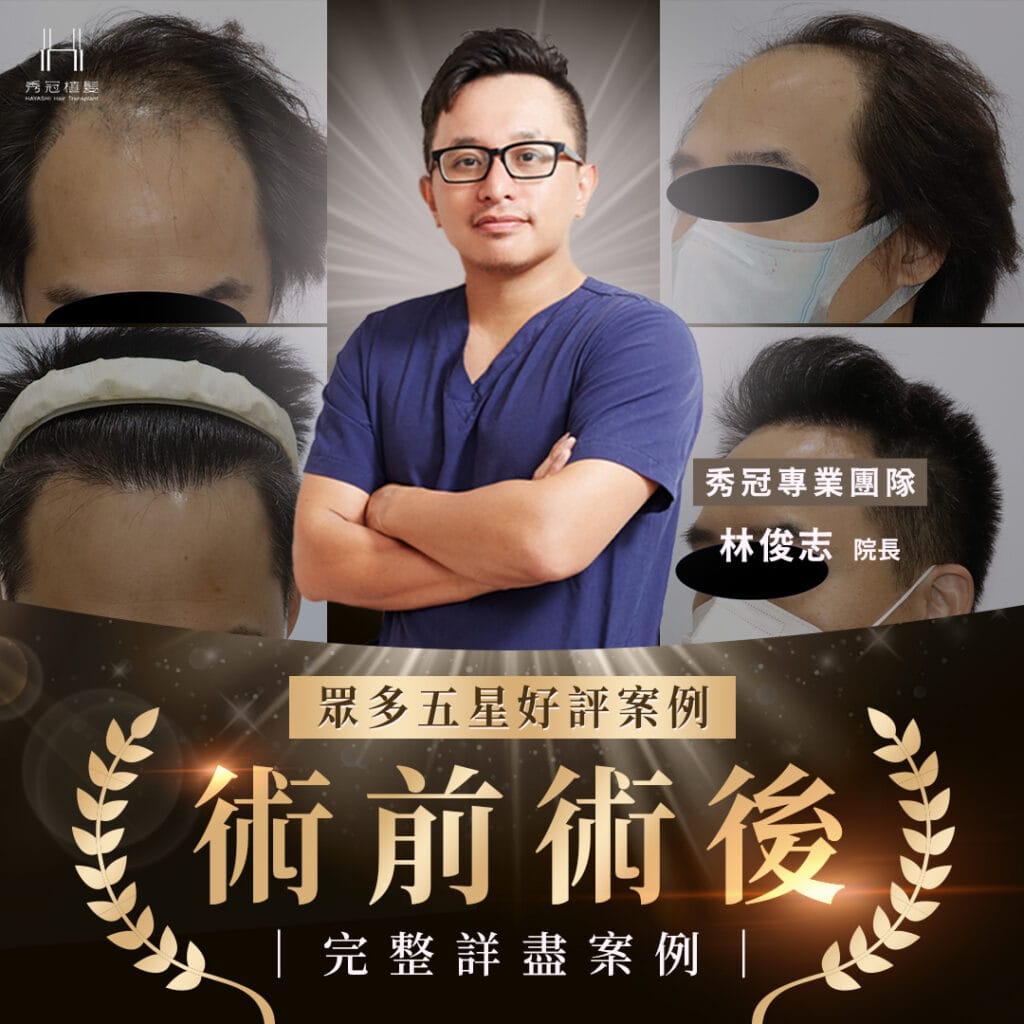 showhair-1