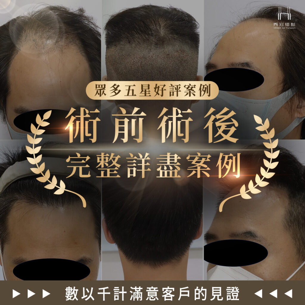 showhair-5